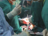 胸科医院多学科协作完成心脏移植手术